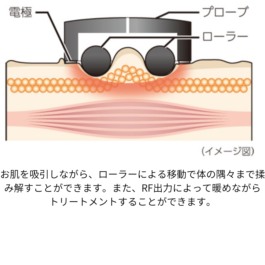 セラピム セルヒート
