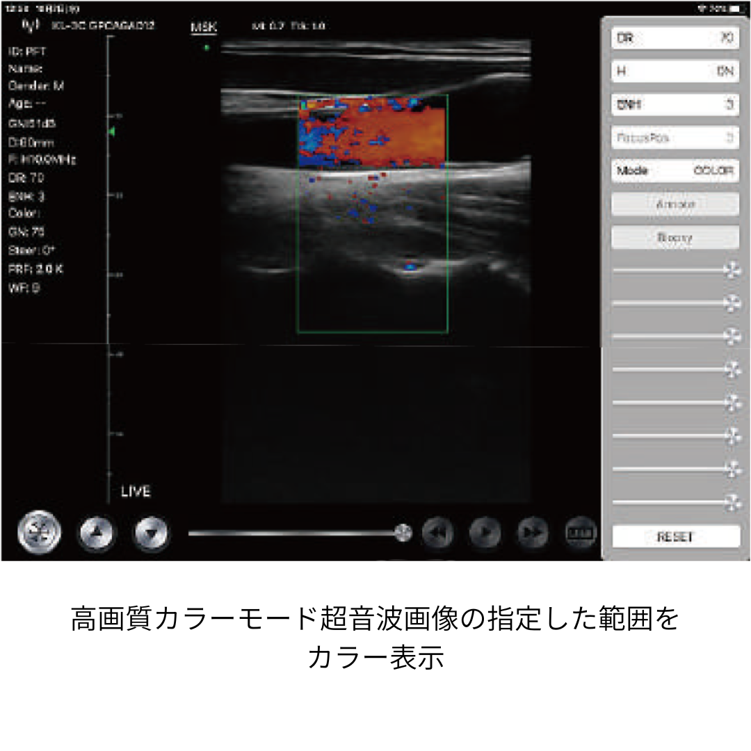 超音波画像計測装置(脂肪・筋肉)ファンボ (FAMUBO-D)(カラードップラー)