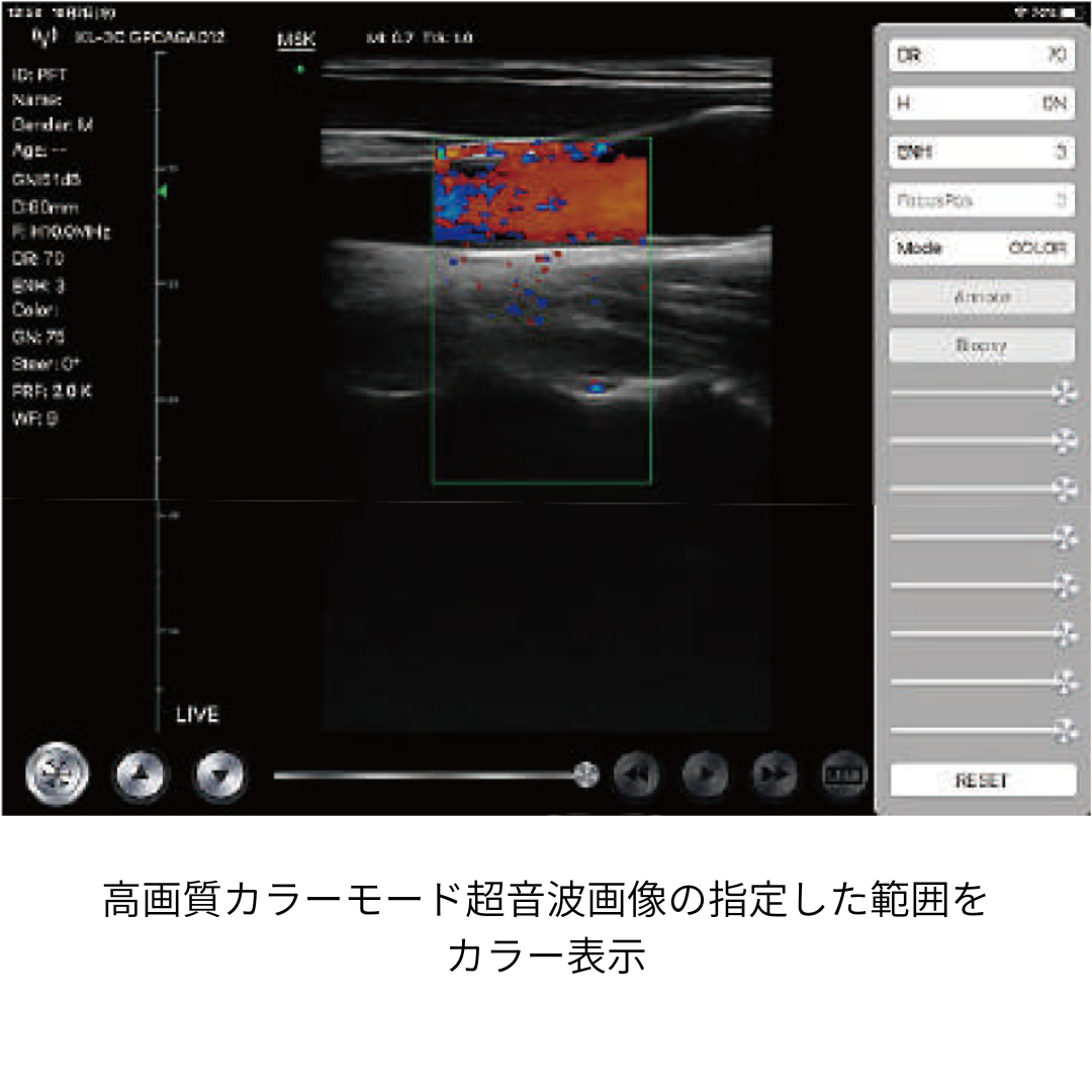 超音波画像計測装置（脂肪・筋肉）ファンボ （FAMUBO-D）（カラードップラー）