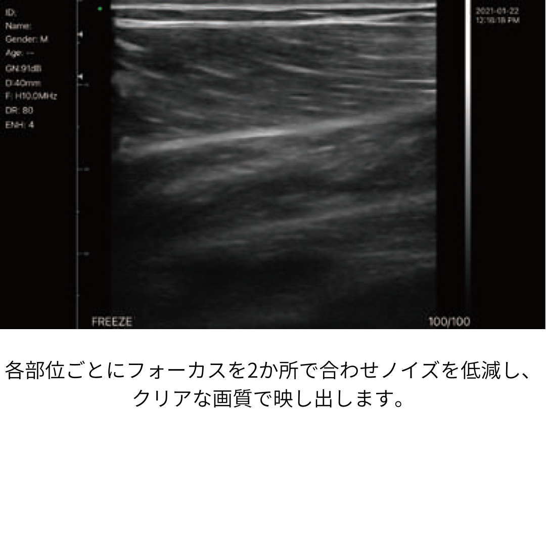 超音波画像計測装置（脂肪・筋肉）ファンボ （FAMUBO-D）（カラードップラー）