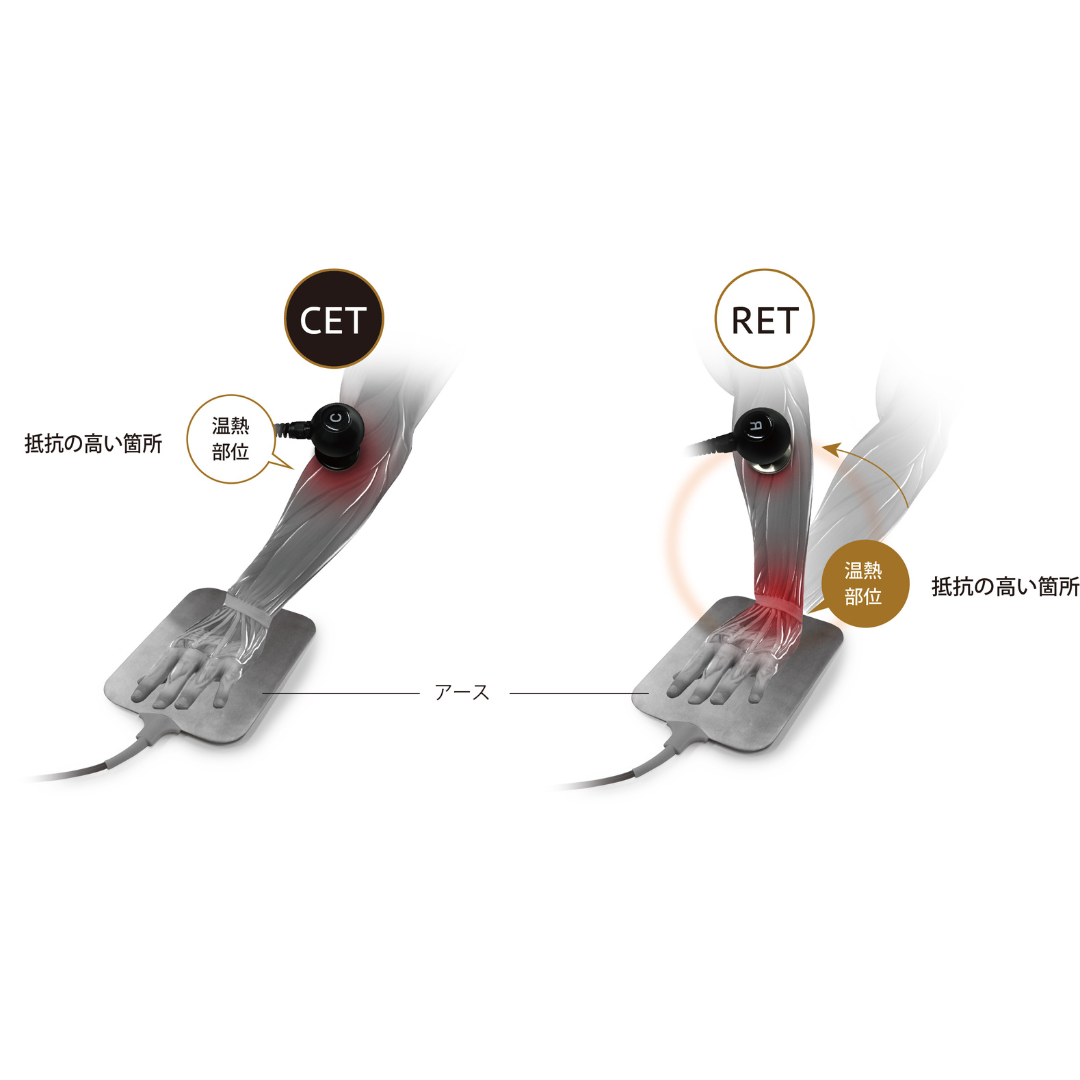 フィジオ ラジオスティム MH2 – 医療用品販売本舗 フィジオ ラジオスティム MH2 – 医療用品販売本舗