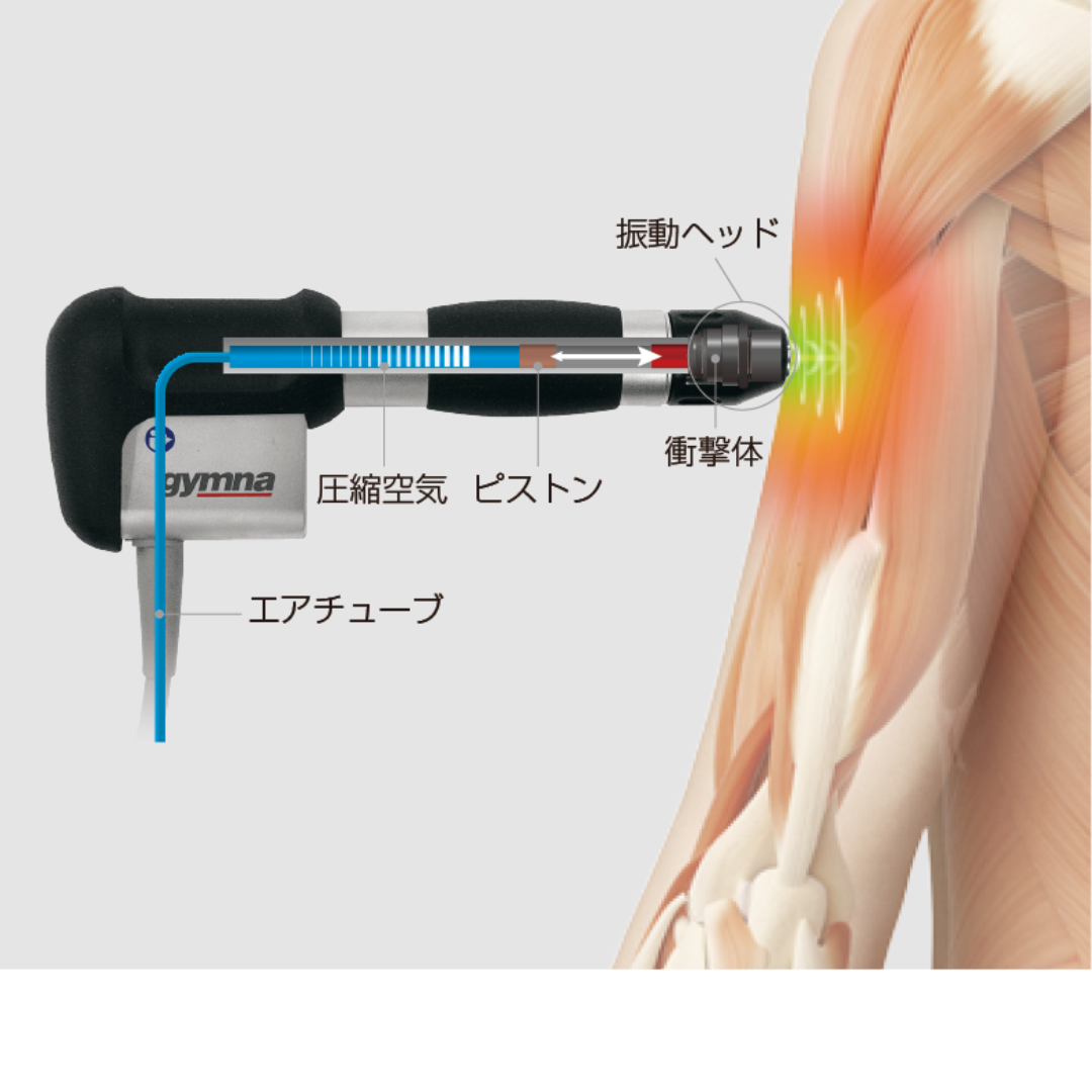 ショックマスター  圧力衝撃波治療器